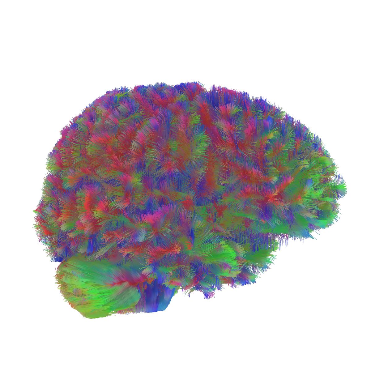 Childhood brain network — diffusion tractography reconstruction