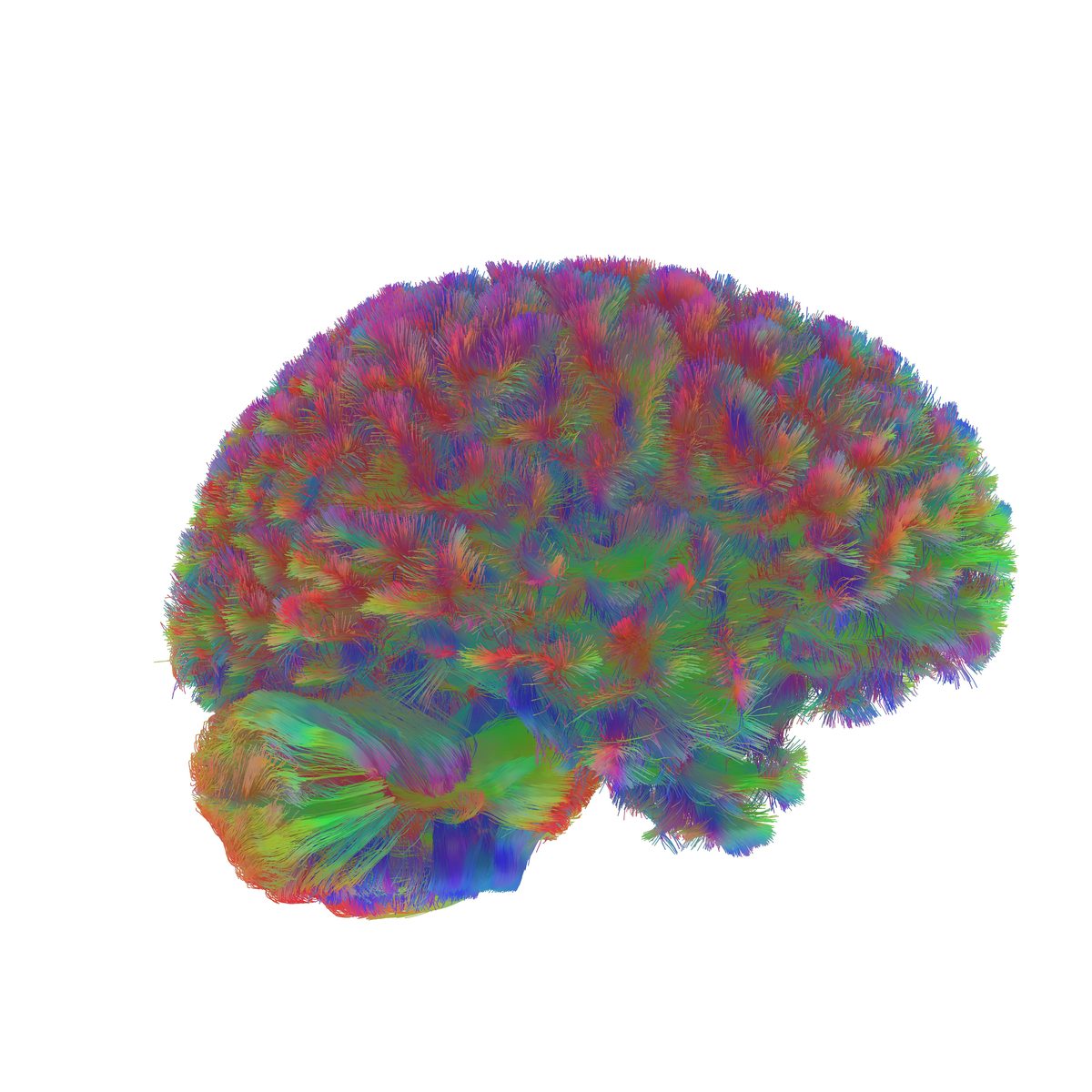 Adolescent brain network — diffusion tractography reconstruction