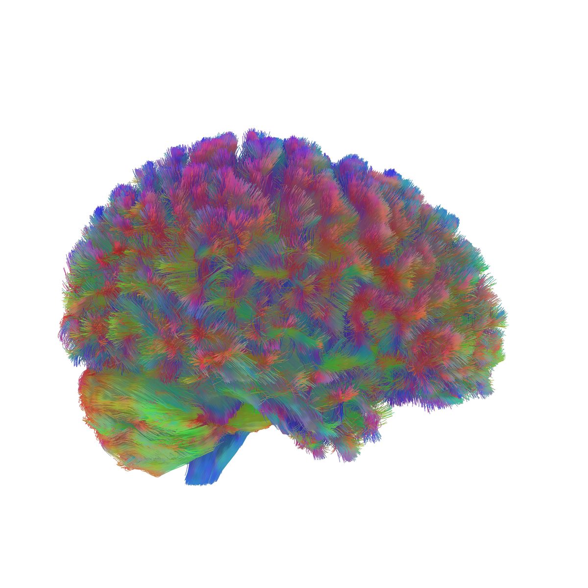Adult brain network — diffusion tractography reconstruction