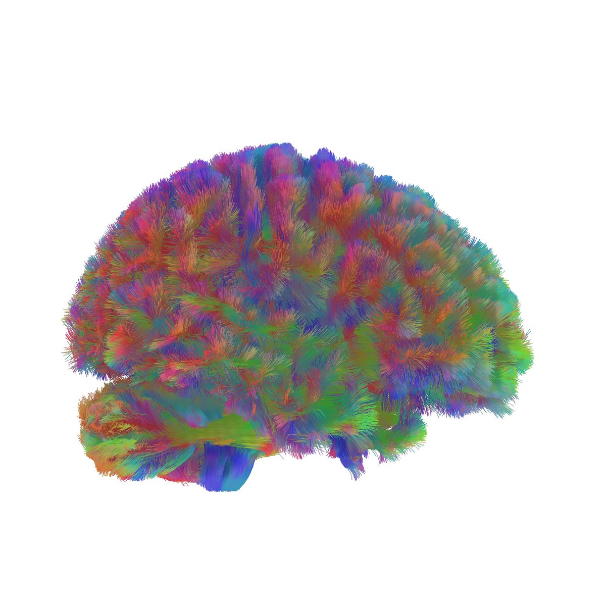 Early-ageing brain network — diffusion tractography reconstruction