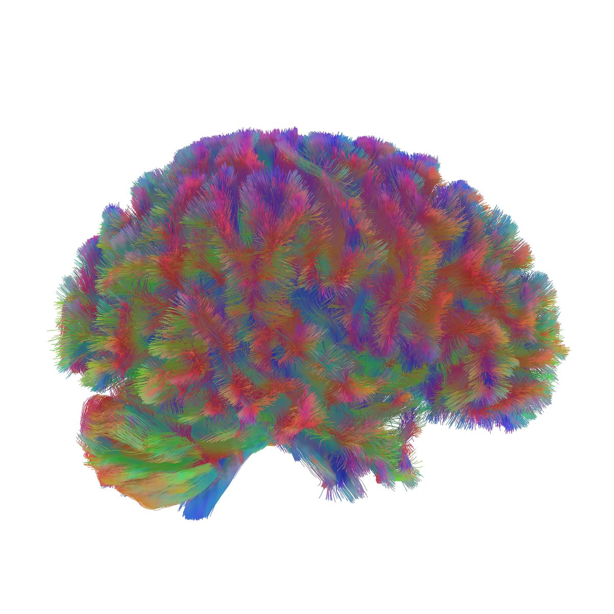 Late-ageing brain network — diffusion tractography reconstruction